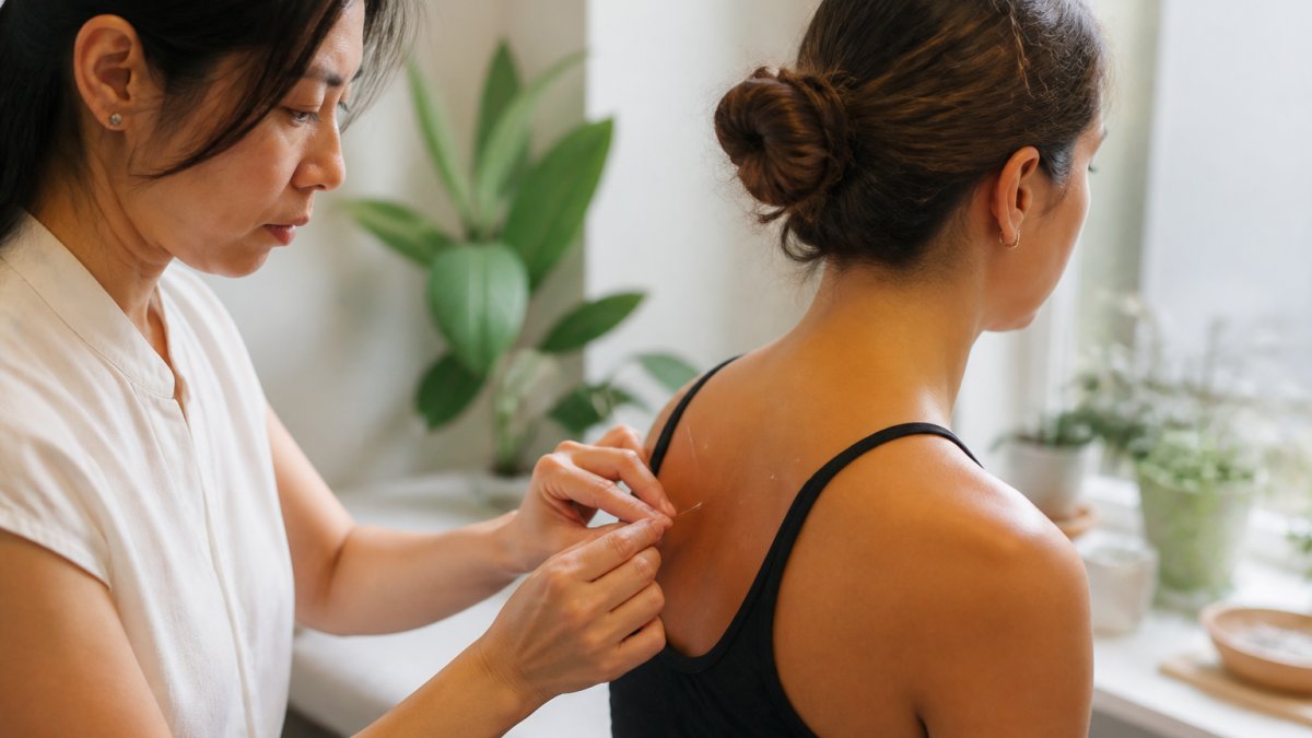 Licensed acupuncturist inserting fine needles into a patient's shoulder muscle during treatment, with the patient seated comfortably in a clinical setting with soft natural lighting