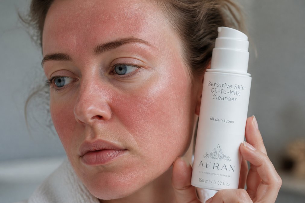 Close-up of person's face showing visible redness, tightness, and irritation across cheeks and forehead with dry patches visible