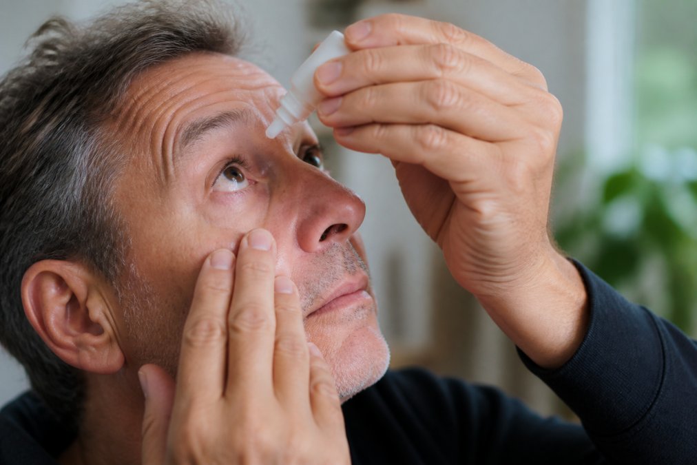 Adult hand holding a small prescription eye drop bottle in natural light, with the person's face partially visible, demonstrating the application of drops to their eye