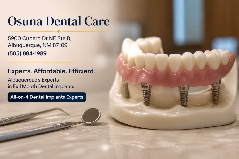 7 Benefits of All-on-4 Dental Implants in Albuquerque