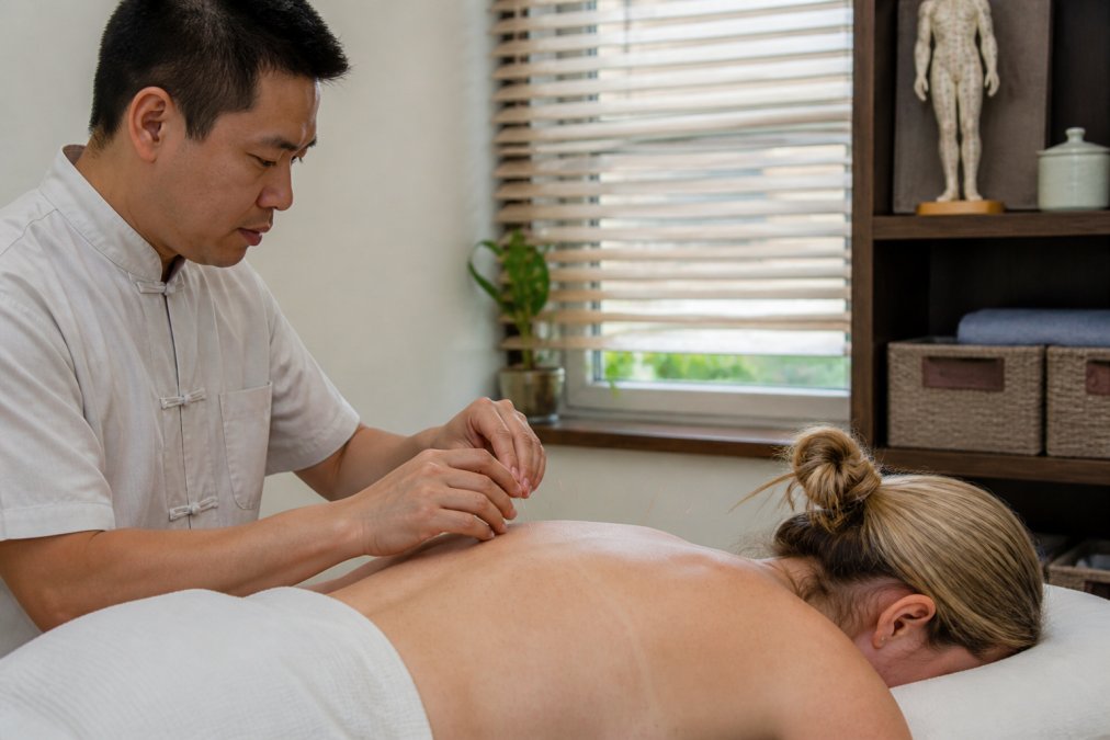 Practitioner placing needles during an acupuncture session for chronic neck pain in a calm clinic room