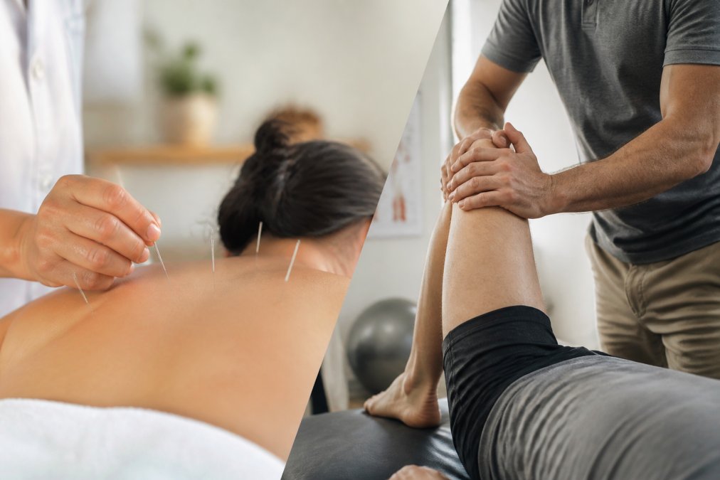 Acupuncture vs Physical Therapy for Joint Pain