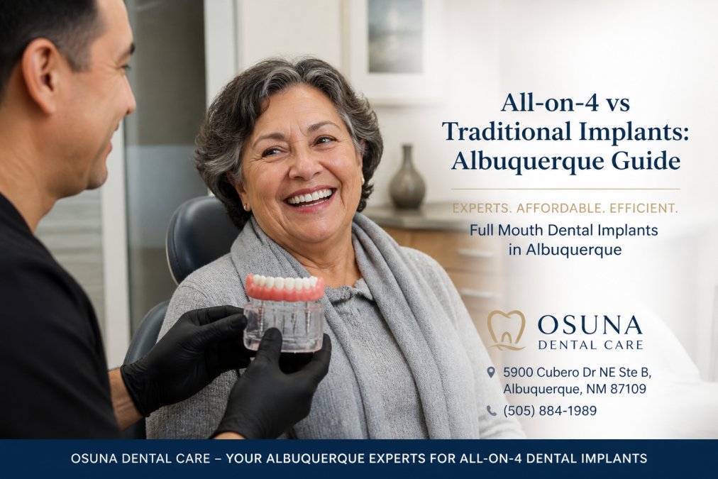 All-on-4 vs Traditional Implants: Albuquerque Guide