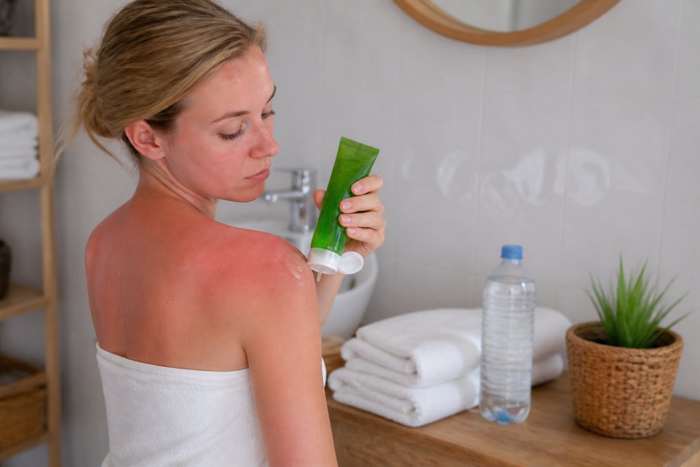 En kvinde med let solrødme på skuldrene påfører en kølende aloe vera-gel fra en lille tube i et lyst badeværelse, med håndklæder og en flaske vand i baggrunden