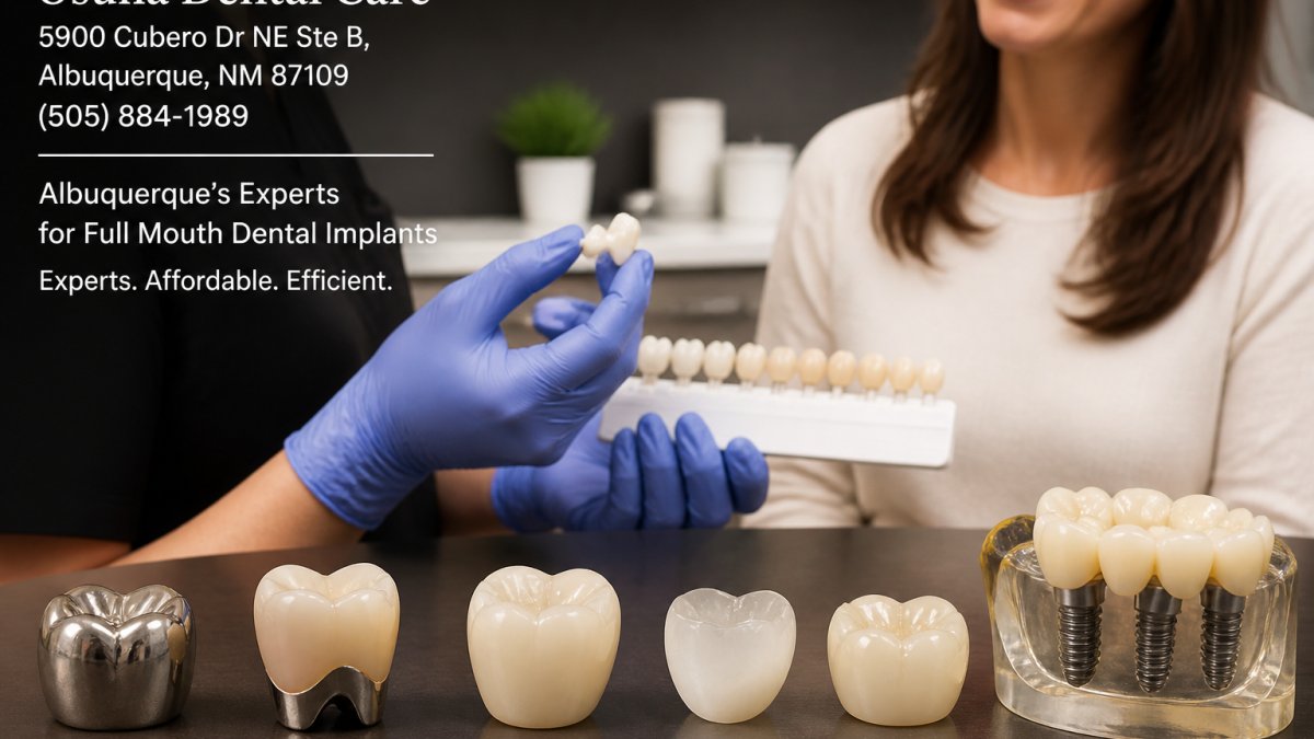Alternatives to Traditional Metal Dental Crowns