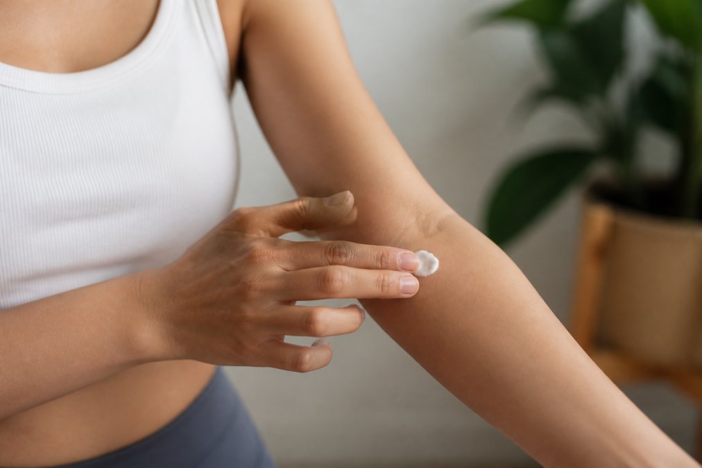 Person carefully applying a small amount of anti-inflammatory cream to the inner forearm for patch testing, demonstrating proper technique with gentle dabbing motions