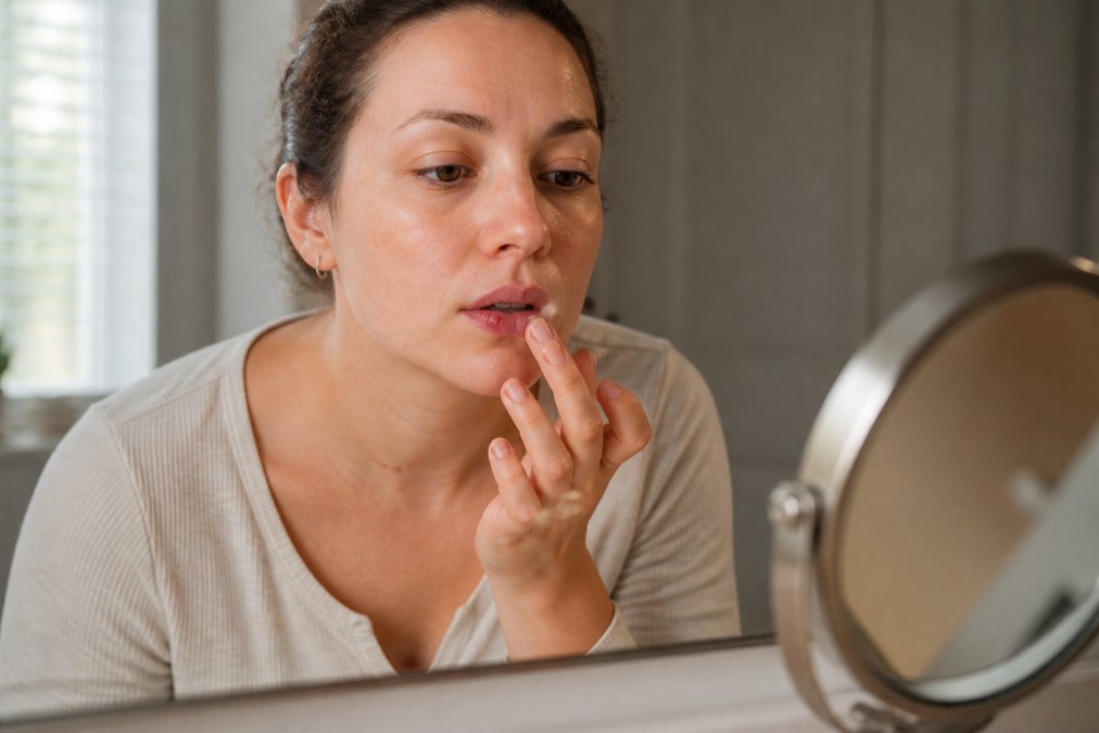 Person carefully applying cold sore treatment to lips using fingertip, demonstrating proper application technique with natural window lighting and a mirror reflection visible