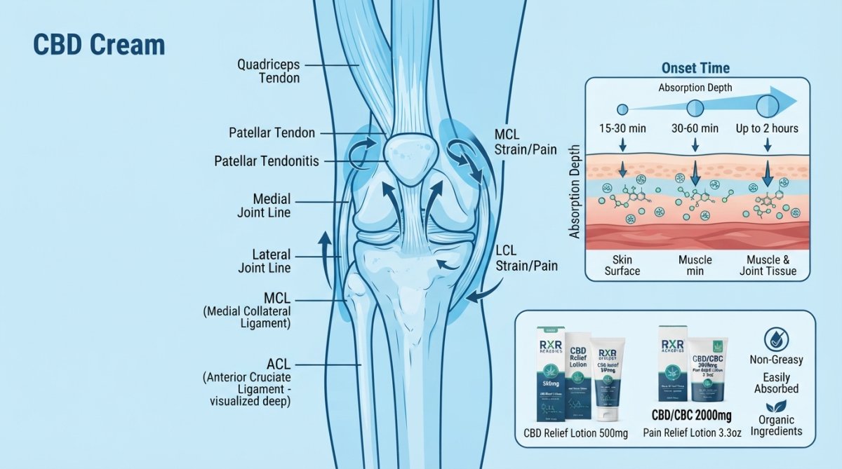 Anatomical diagram of the knee showing medial and lateral joint lines, ligament locations (MCL, LCL, ACL), patellar tendon, and quadriceps tendon, with application zones highlighted for different pain types