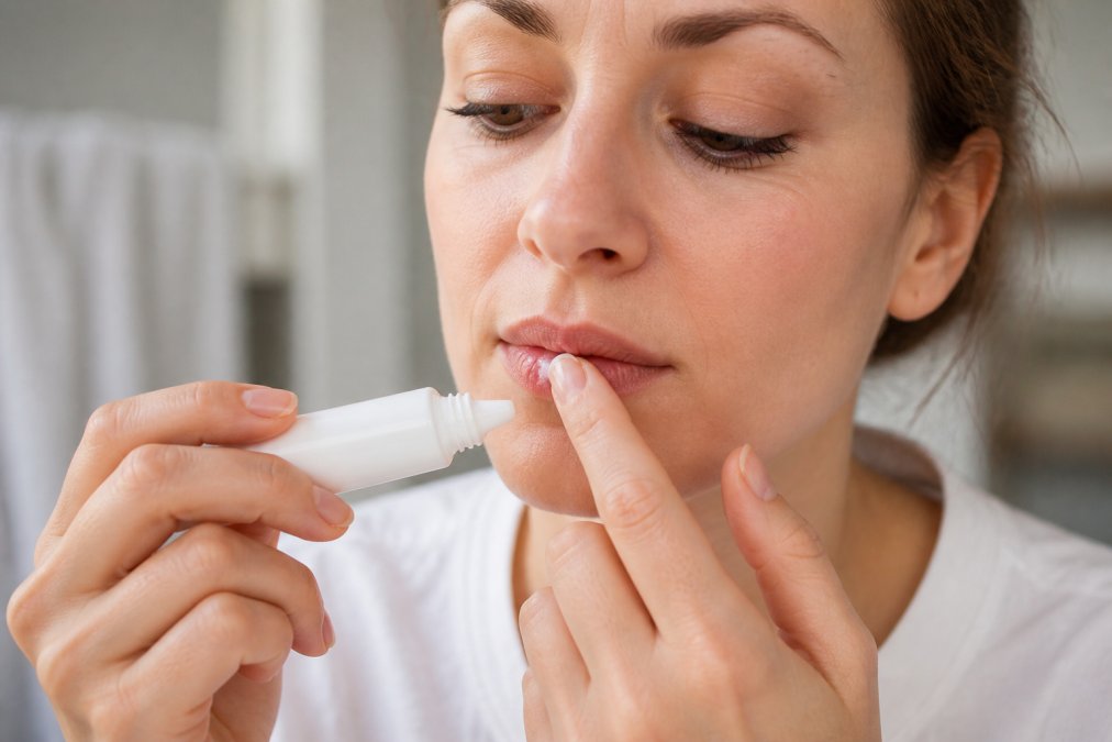 Close-up of a person applying a small amount of white cream from a tube onto their lip with a clean fingertip, soft natural light, focused expression