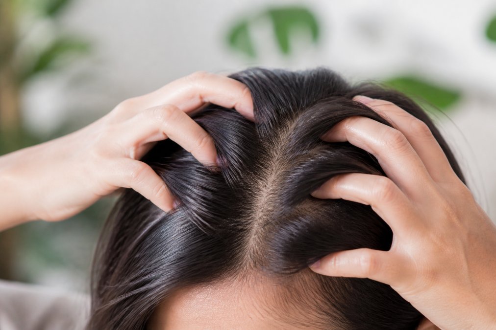 Close-up of hands performing a gentle scalp massage with fingertips on a person's head, showing healthy scalp texture and natural light through hair