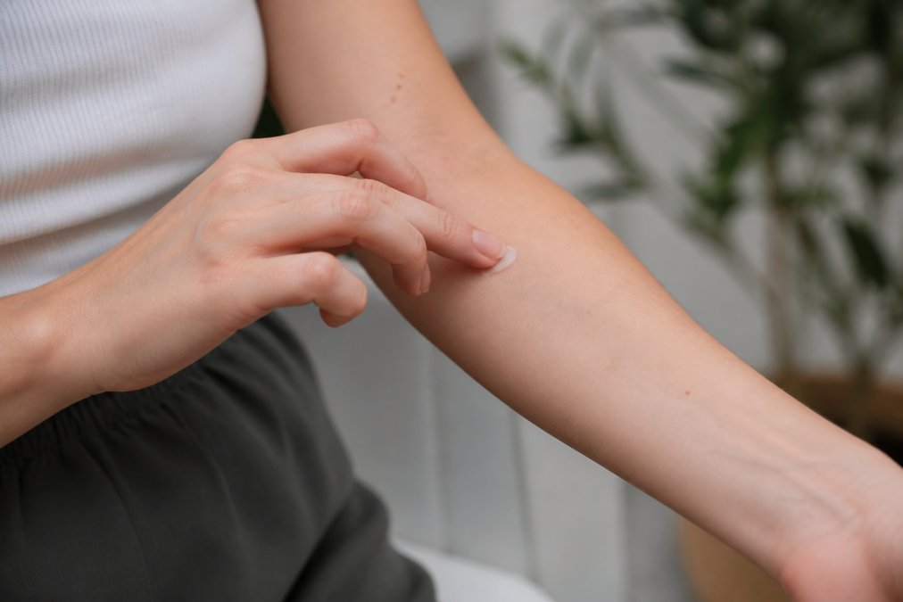 Close-up of person applying small amount of skincare product to inner arm for patch testing, showing careful application technique with fingertip