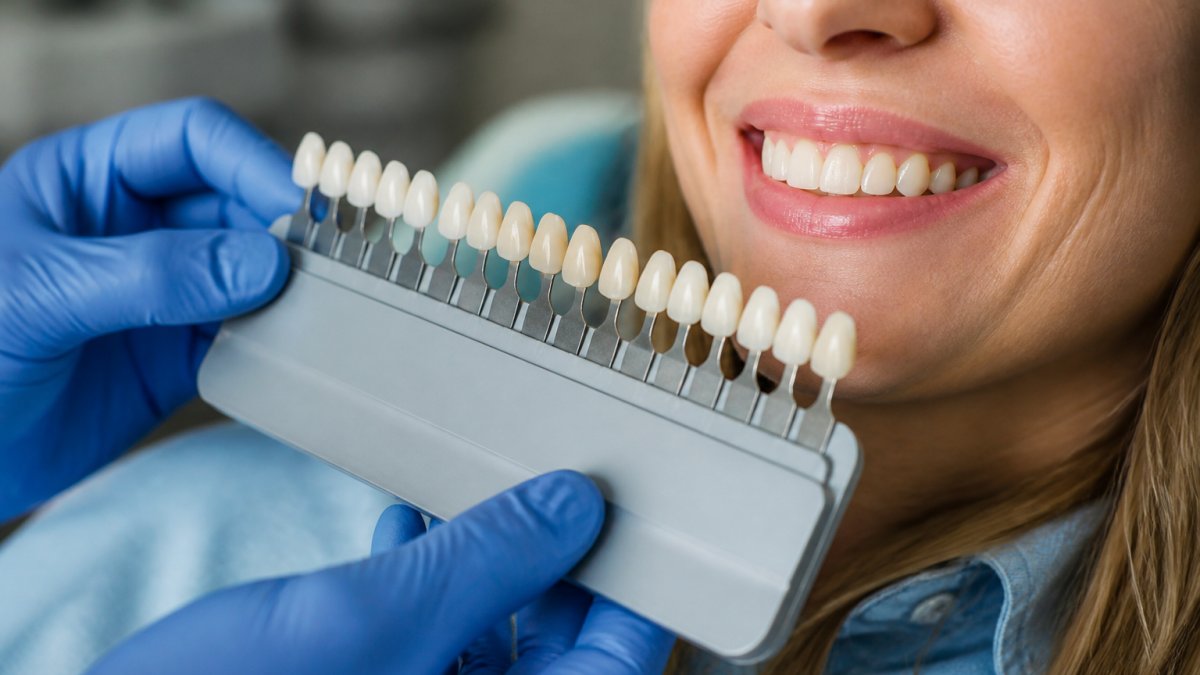 Close-up of a dentist holding a porcelain veneer shade guide next to a patient's smile in a bright treatment room, showing natural tooth color matching