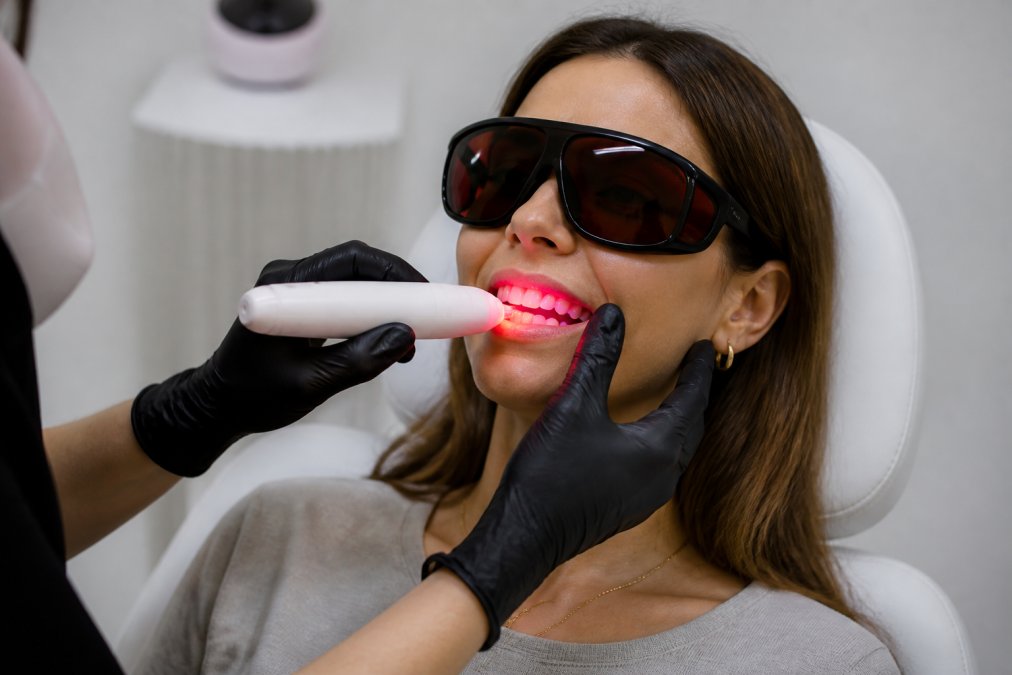Close-up of a person using a handheld red light therapy device positioned near the gum line during a treatment session in a bright wellness clinic