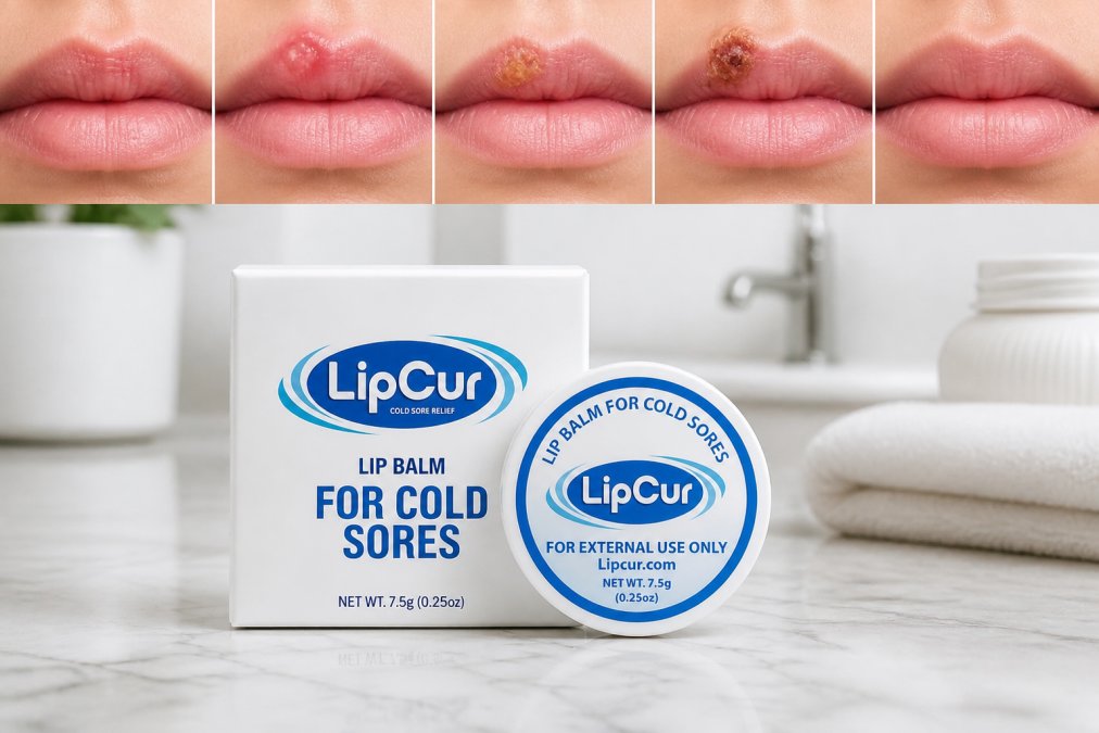 Series of progressive healing stages of cold sores shown through close-up photographs of lips at different days: tingling stage, blister formation, ulceration, crusting, and healing phases with natural lighting