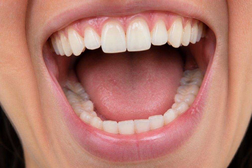 Close-up of a person's open mouth showing healthy pink gums and clean teeth with natural lighting highlighting the oral cavity detail