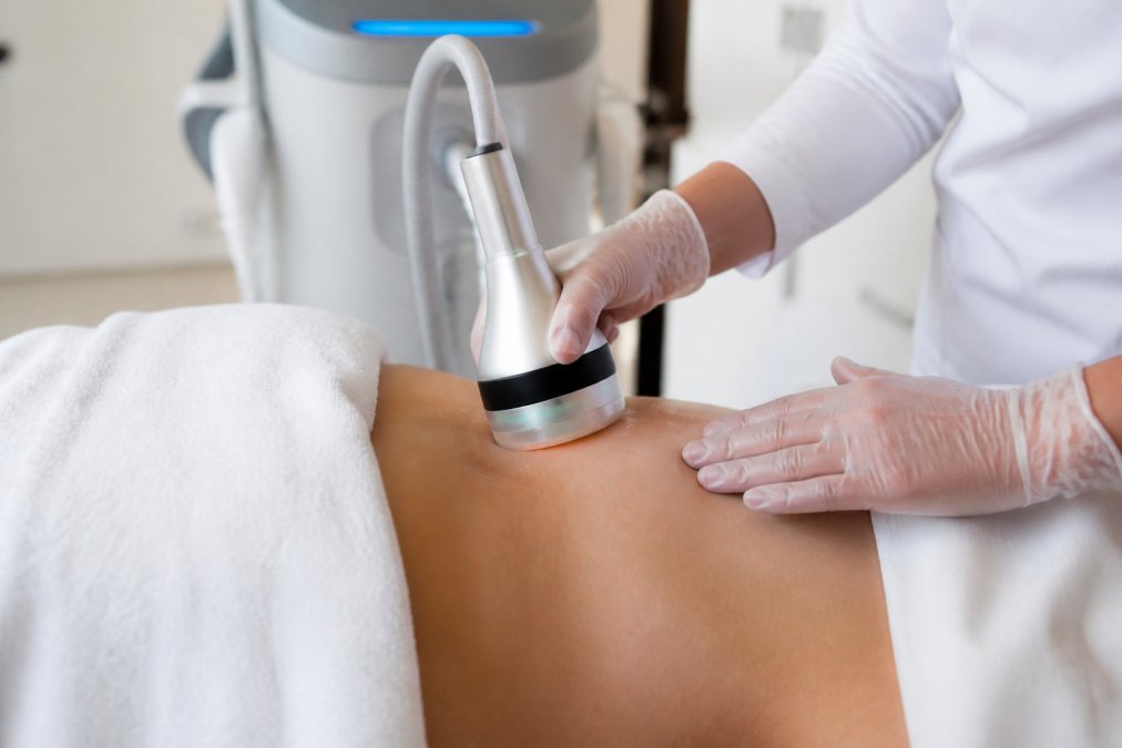 Close-up of advanced aesthetic technology equipment in a clinical setting, such as a laser or radiofrequency device with sleek metallic finish, with a healthcare provider's hands preparing the treatment area on a patient's skin