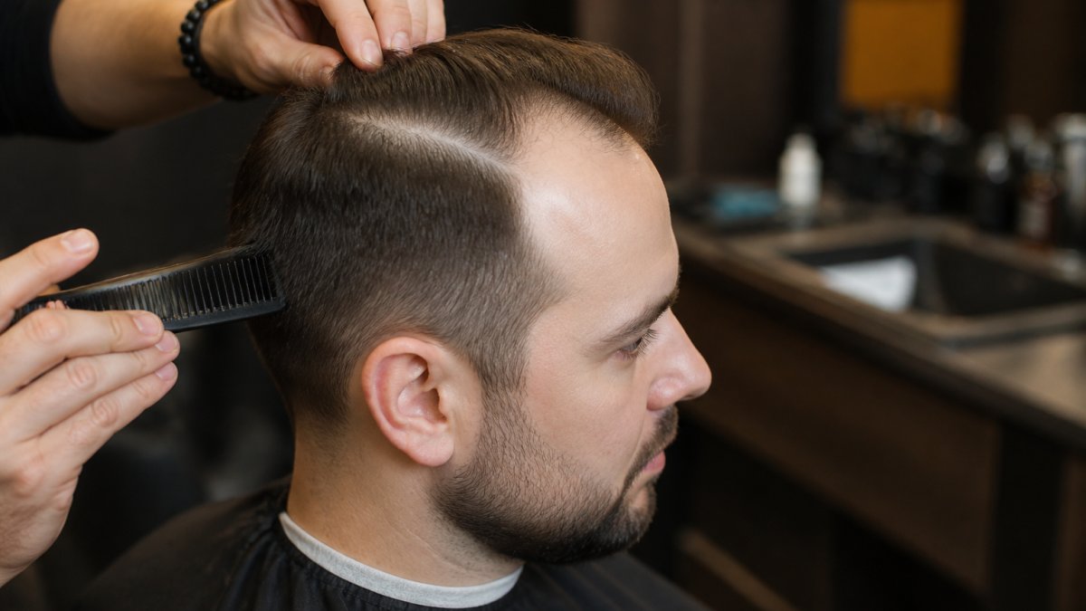 Coupe de cheveux homme calvitie naissante