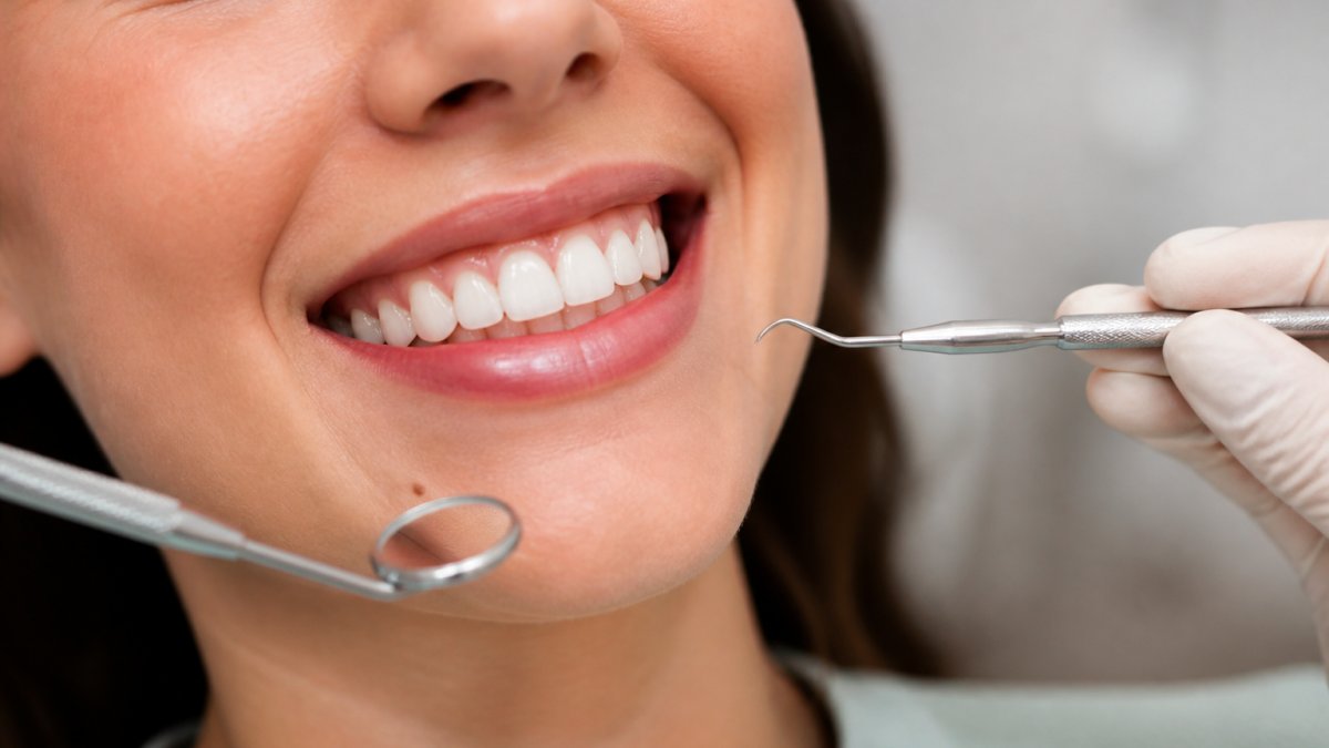 Close-up of a patient's smile showing healthy teeth and natural gum tissue in bright clinical lighting, demonstrating aesthetic dental restoration