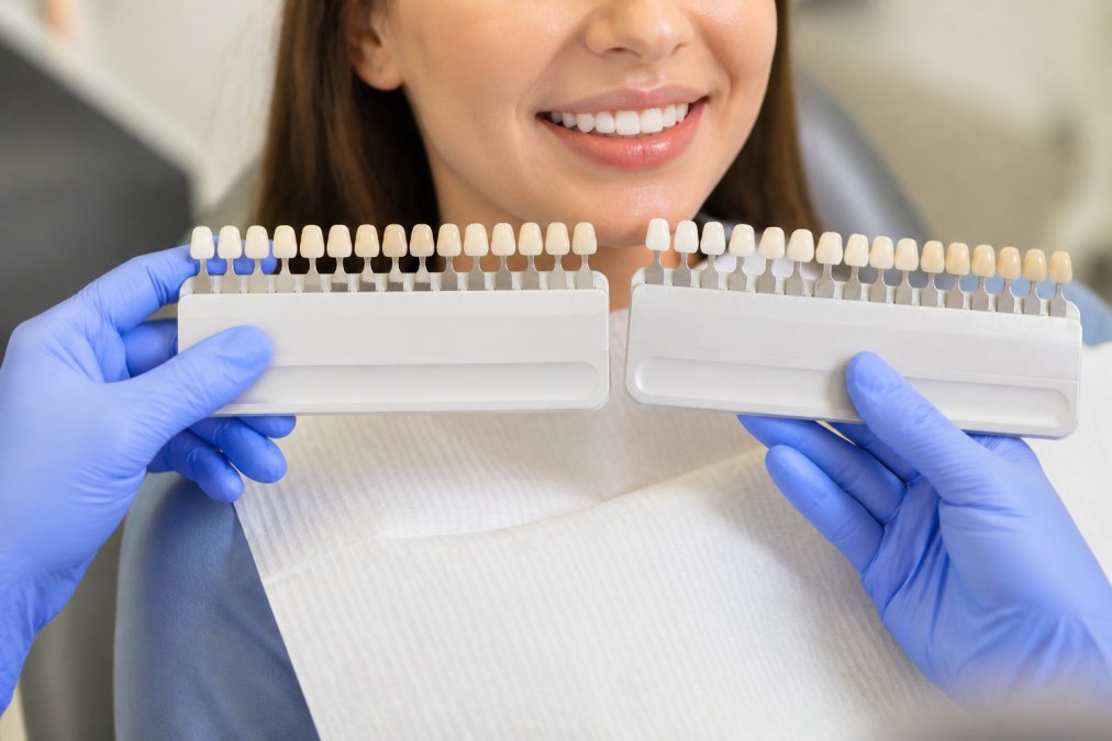 A close-up photograph of a dentist's gloved hands holding two different shade guides next to a patient's smile, with porcelain and composite samples visible on a clean clinical tray under bright clinical lighting