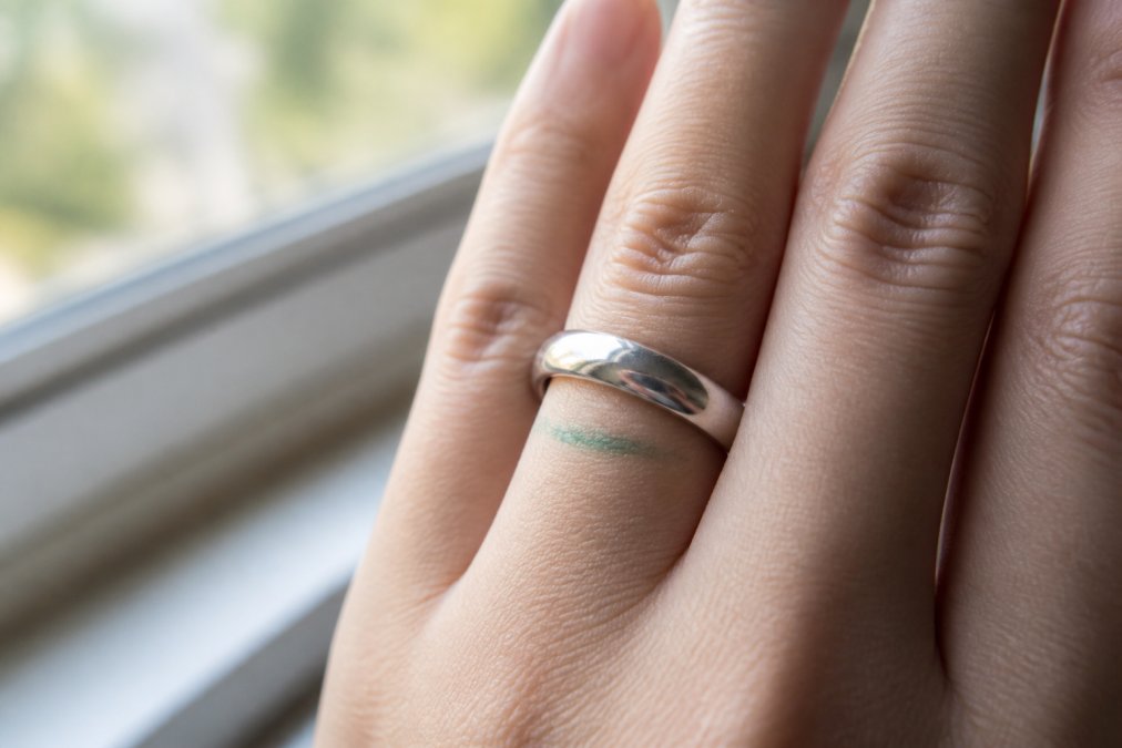 Close-up of a hand wearing a 925 sterling silver ring, with a faint green mark on the finger next to the ring, shot in soft natural window light