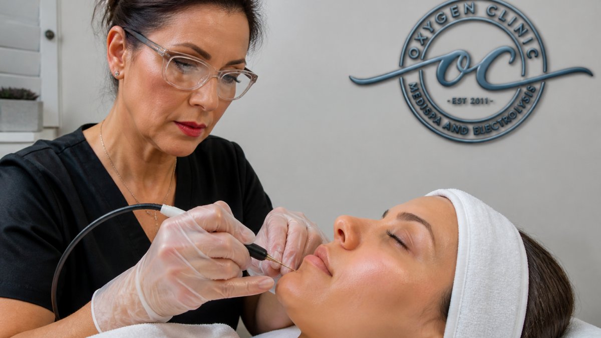 Professional electrologist using a fine probe on a client's chin during an electrolysis vs laser treatment session