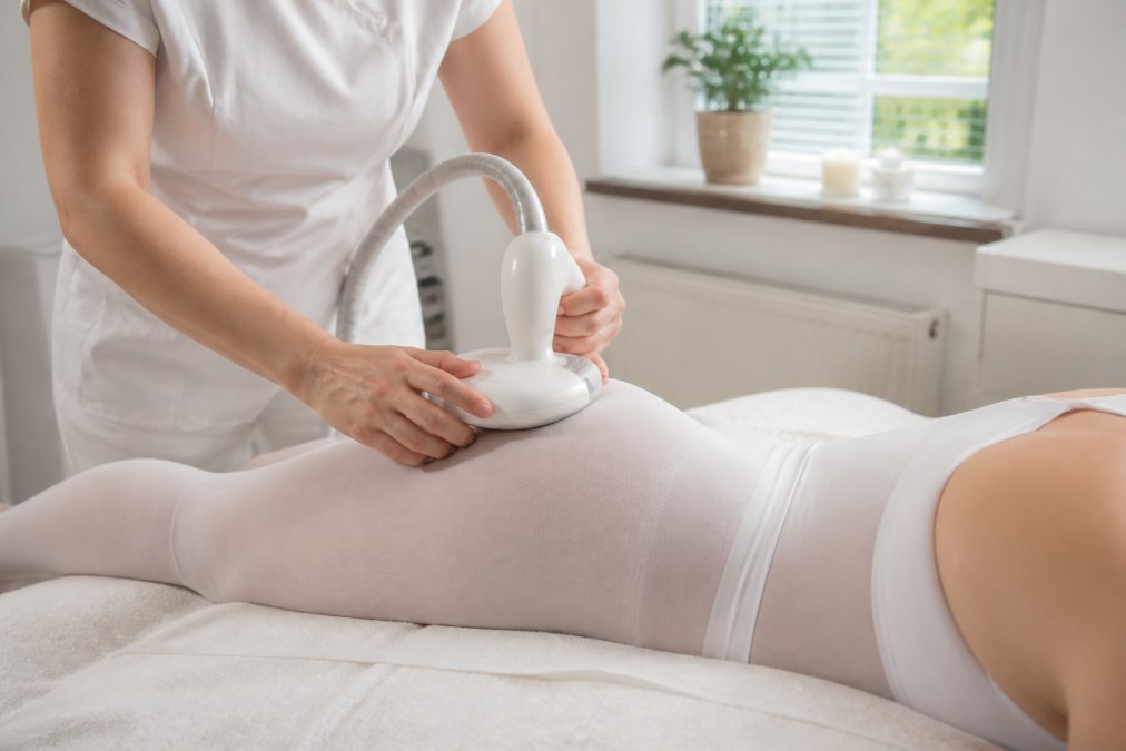 Ervaringen met endermologie voor cellulite: wat werkt