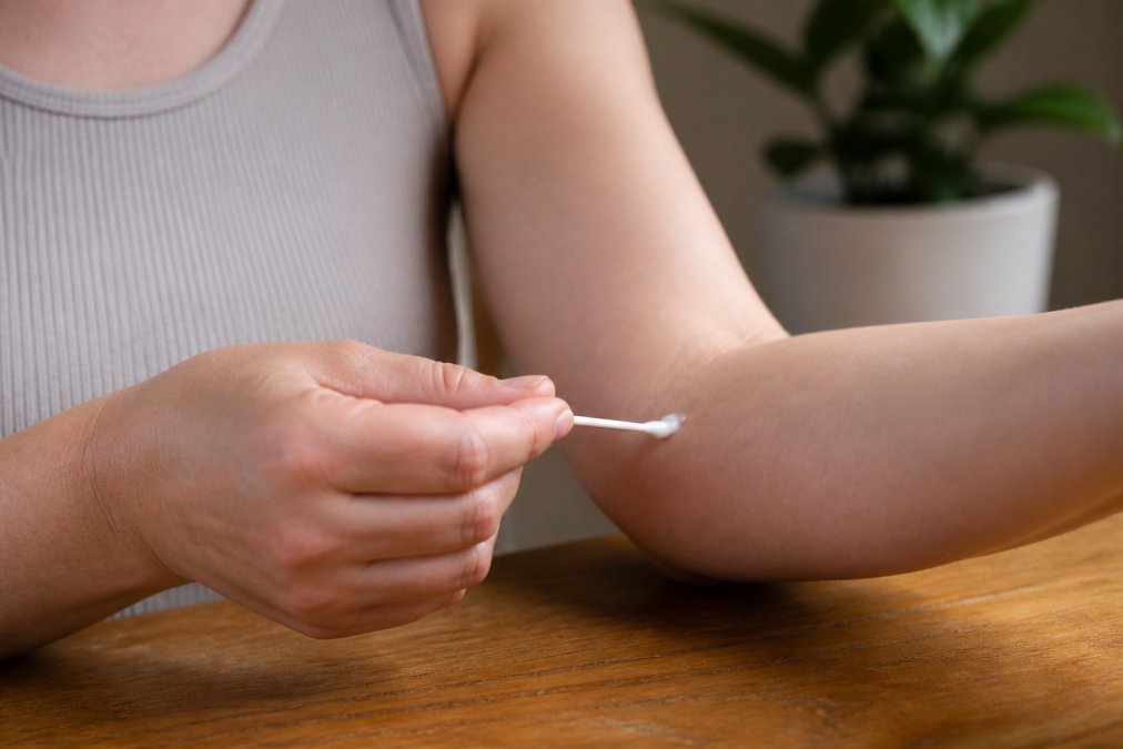 Close-up of a person applying a small drop of lotion to the inside of their forearm with a cotton swab, clean skin visible, soft natural light