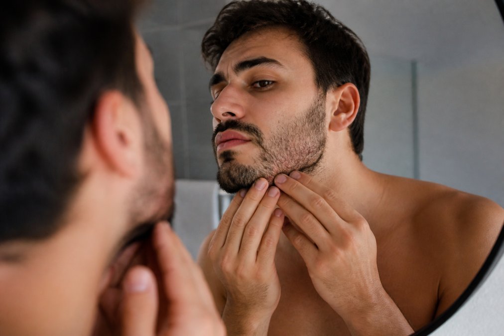 Éviter les boutons après une taille de barbe