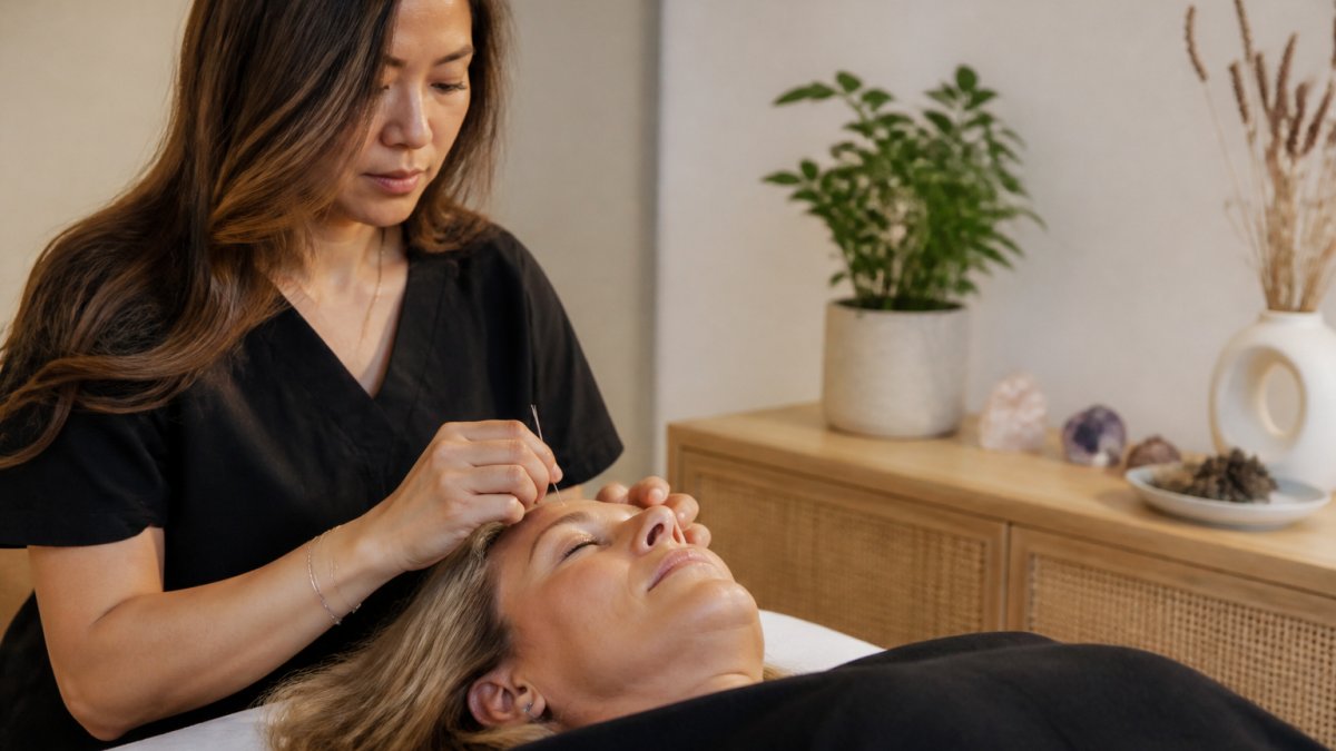 A calm treatment room with a licensed acupuncturist gently inserting a fine needle into a relaxed patient's face, soft natural light, clean and professional setting