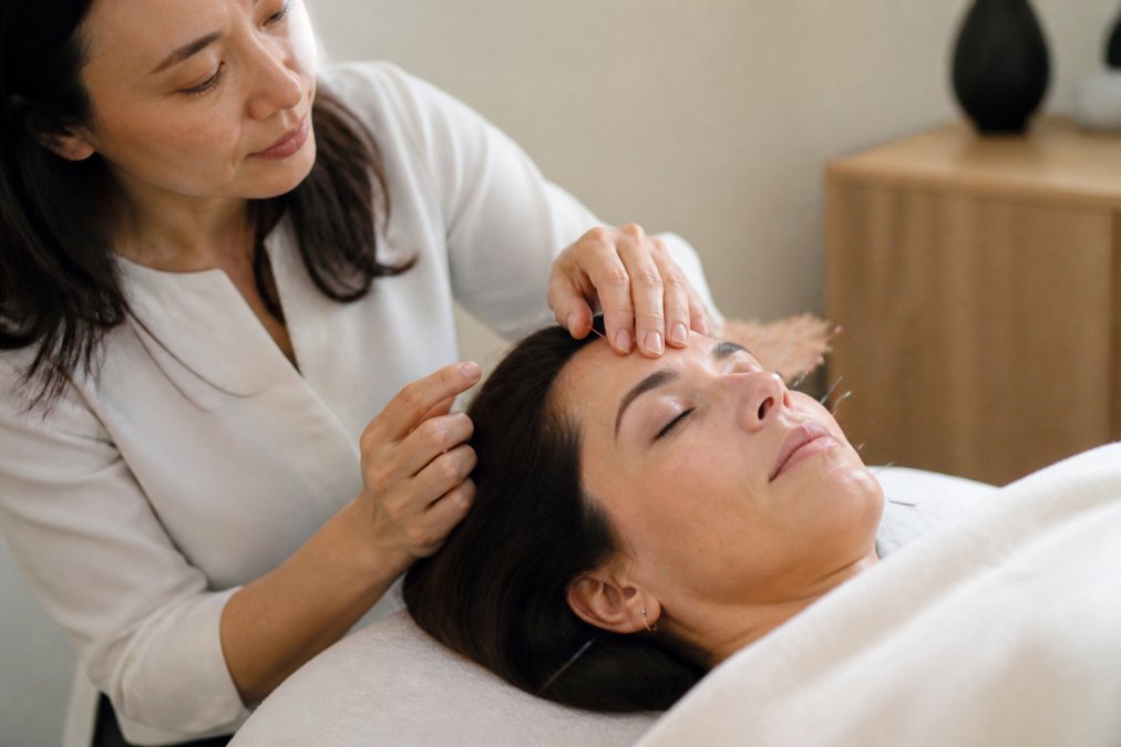Professional practitioner performing facial acupuncture on relaxed client's face, showing fine needles placed on forehead and cheek area with soft lighting in calm treatment room
