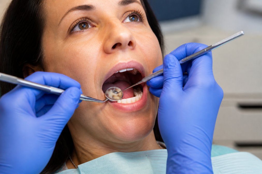 Failing Fillings: What to Do Now
