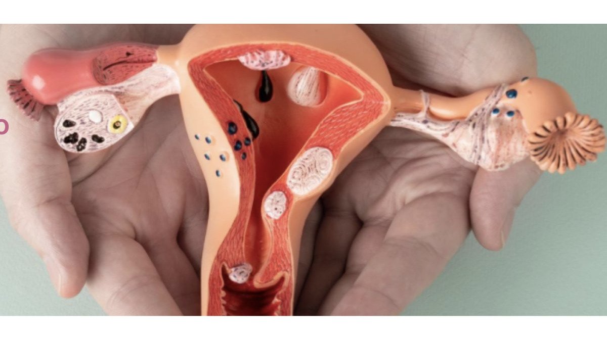 Best Private Gynaecologist in London for Laparoscopic Surgery