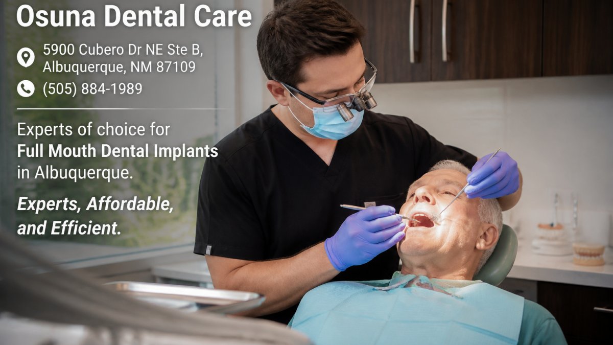 Full Mouth Restoration Procedure Steps: A Complete Guide