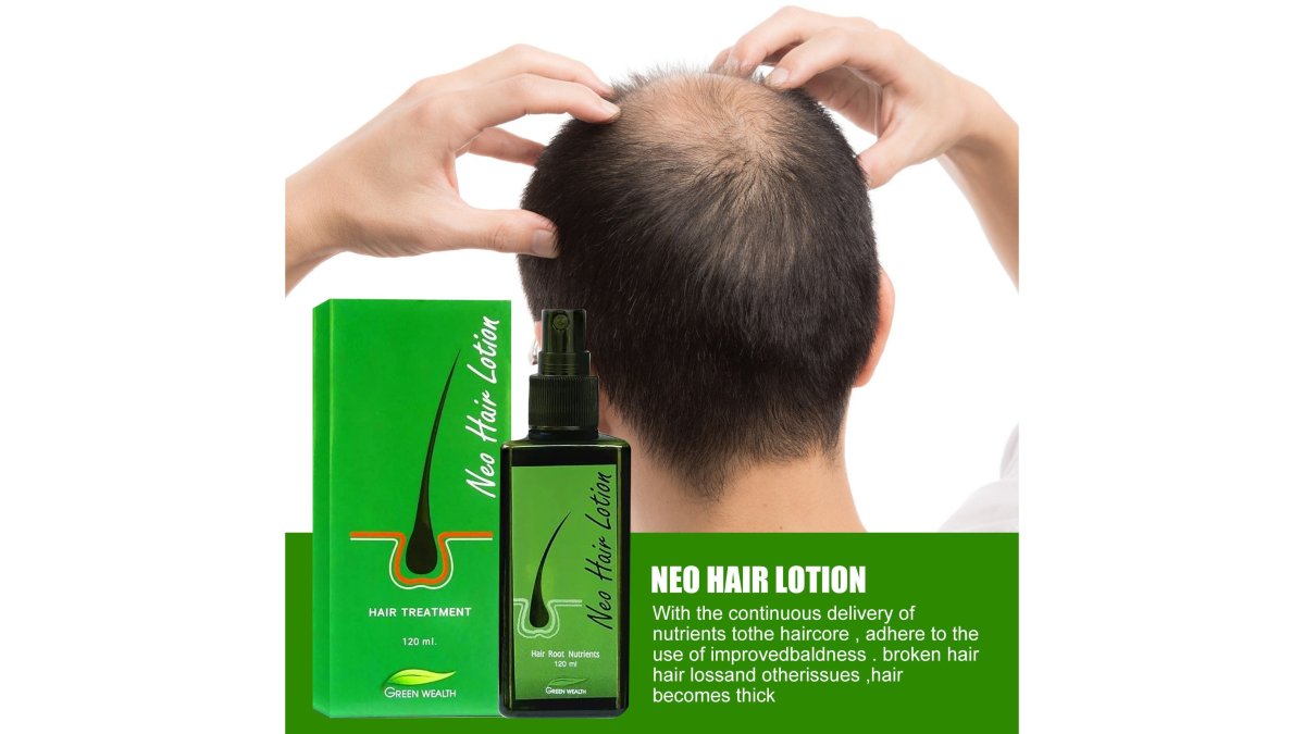 Hair Care Growth Lotion Spray