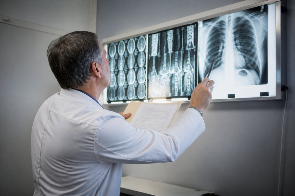 Medical professional reviewing X-ray and diagnostic imaging on a light box while holding patient file with medical records in clinical setting