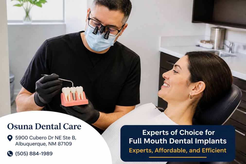 How to Choose a Dental Implant Specialist