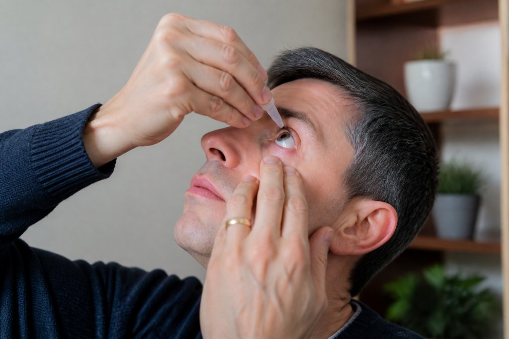 Close-up of hands applying eye drops from a single-dose vial to the eye, showing proper technique with head tilted back and fingers gently pulling lower eyelid