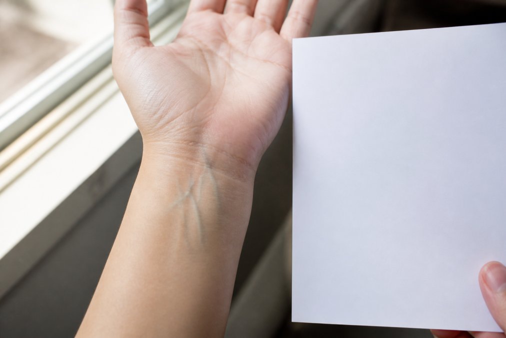 Woman's wrist held under natural window lighting, showing vein color clearly visible, with white paper positioned nearby for comparison test