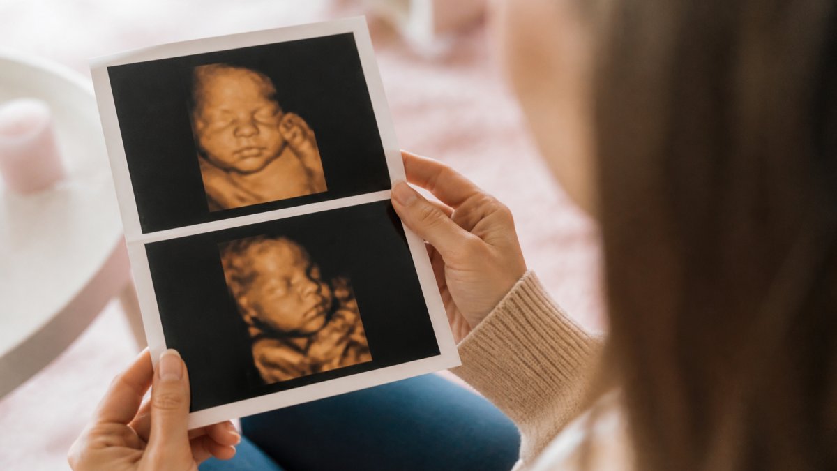 How to Get Clear 3D Images of Your Baby