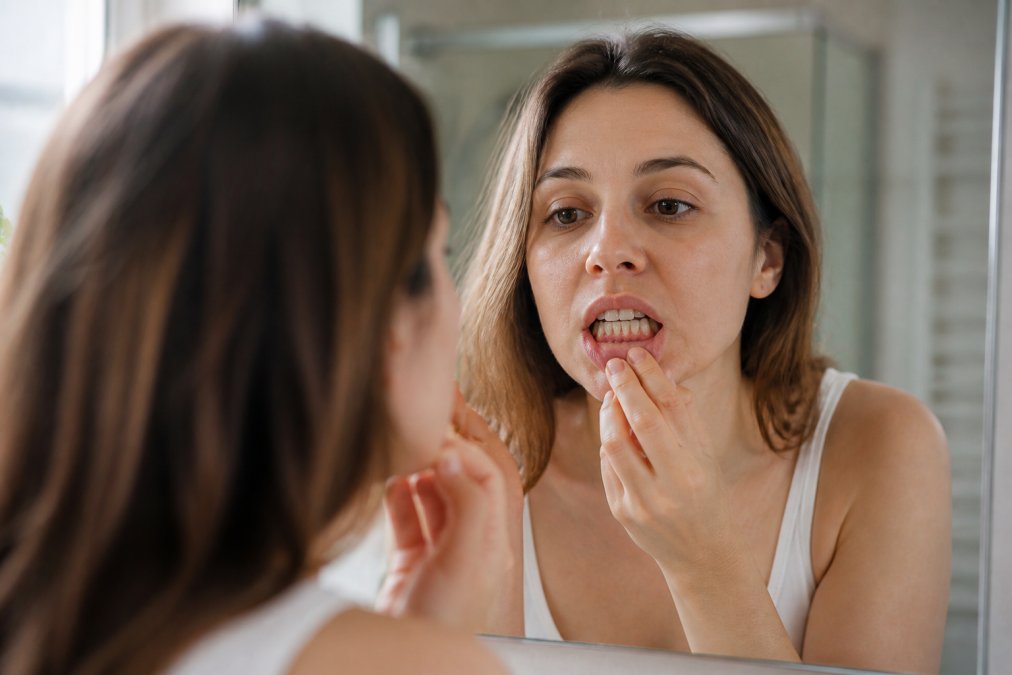 Person checking their gumline in a mirror to help prevent gum recession symptoms