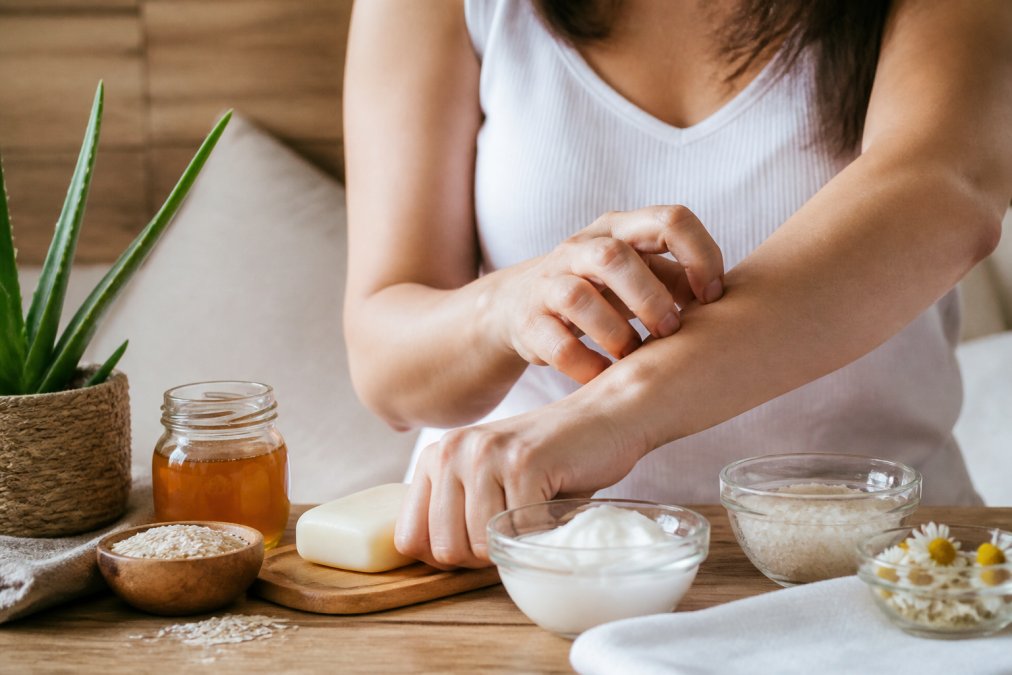 How to Soothe Itchy Skin Naturally: 7 Calming Steps