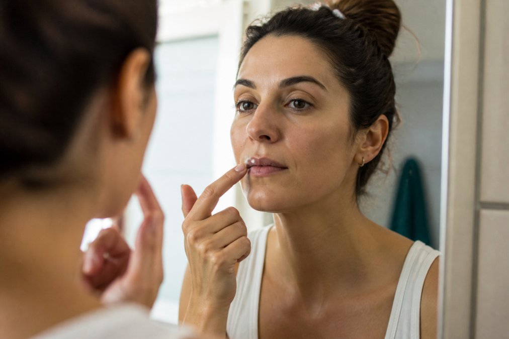 Close-up of a person gently applying a small amount of cream to their lip area with a clean fingertip, natural bathroom lighting, calm and focused expression