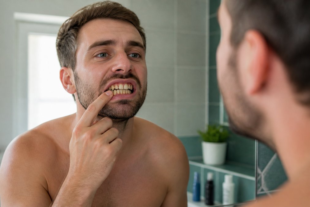 Side-by-side comparison of whiten teeth safely at home