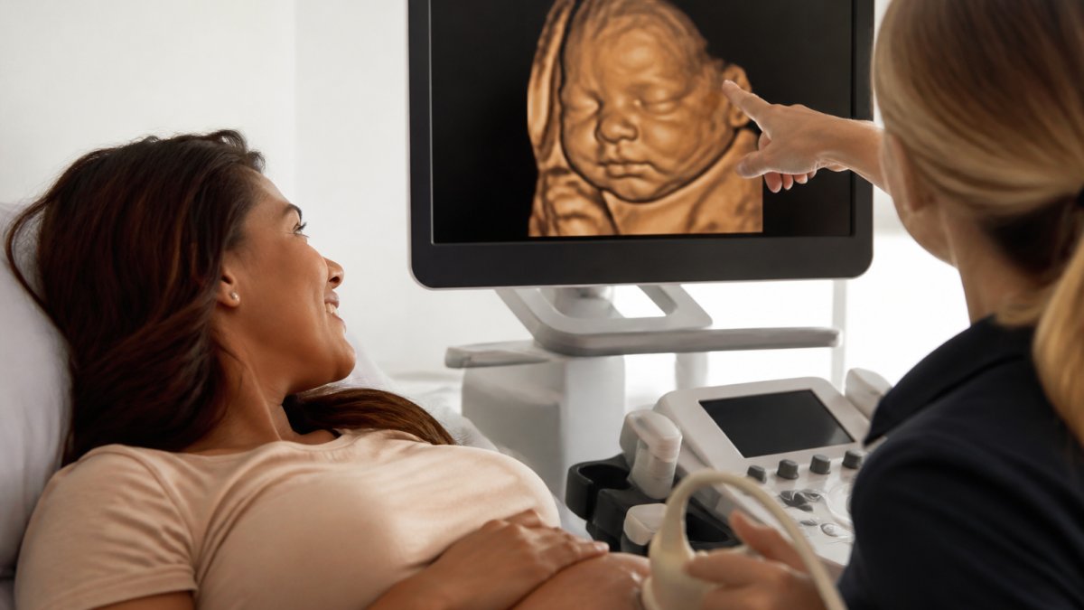 Is 3D Ultrasound Worth It? A 2026 Guide for Parents