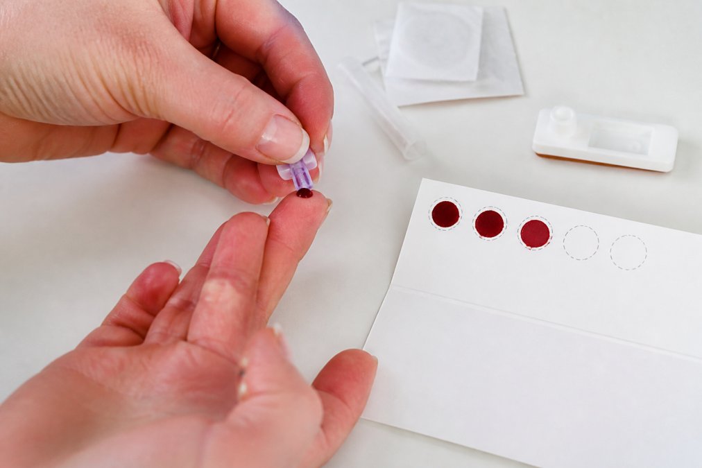 Close-up of a fingerprick blood sample being collected onto a dried blood spot card at home, with sterile lancet and collection kit visible on a clean white surface