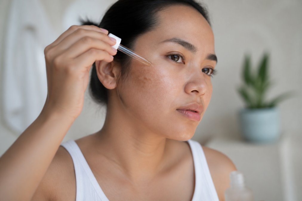 Close-up of a person applying vitamin C serum to their face in soft natural morning light, with visible hyperpigmentation on cheek area