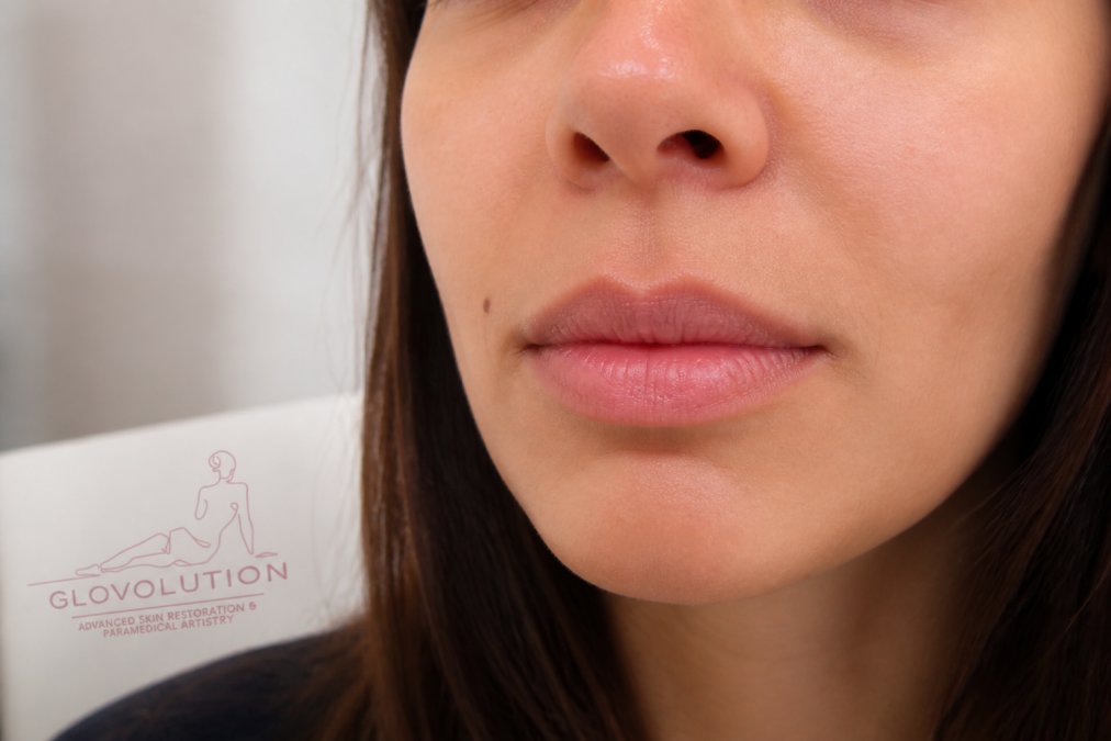 Close-up of a woman's lips showing natural asymmetry and uneven tone in soft natural lighting