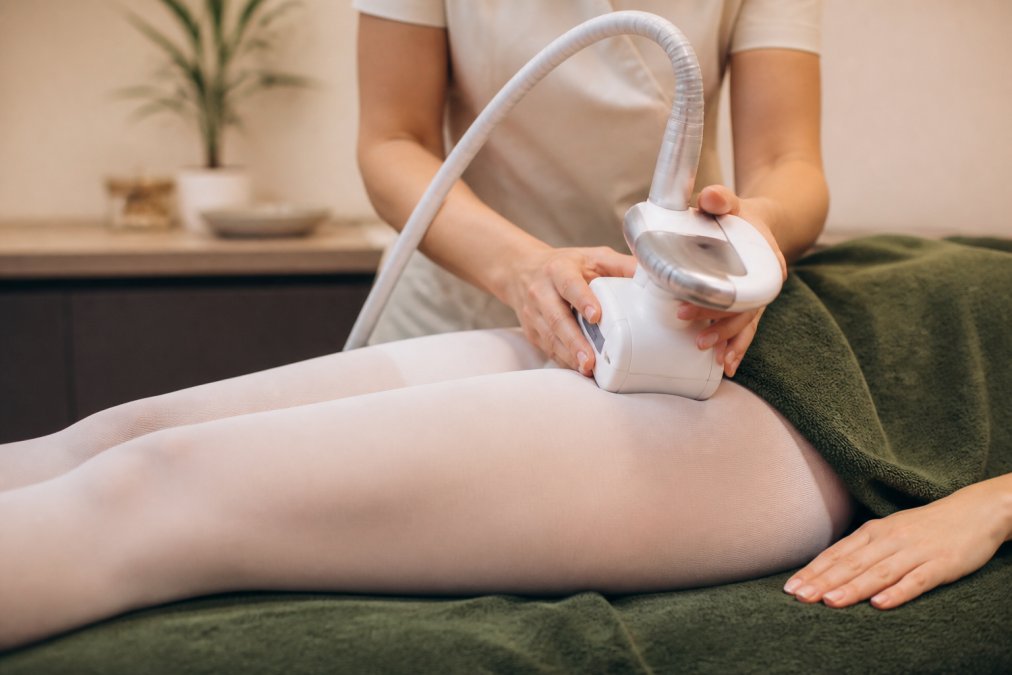 LPG Endermologie, jouw behandelplan