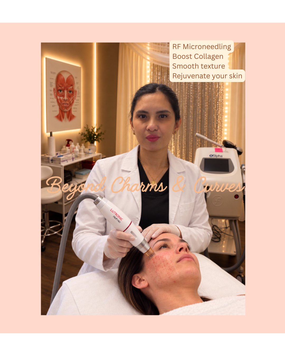 Microneedling for Deep Facial Wrinkles: What to Expect