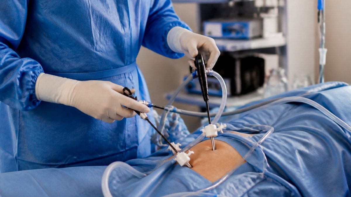 Minimally Invasive Gynaecological Surgery Benefits